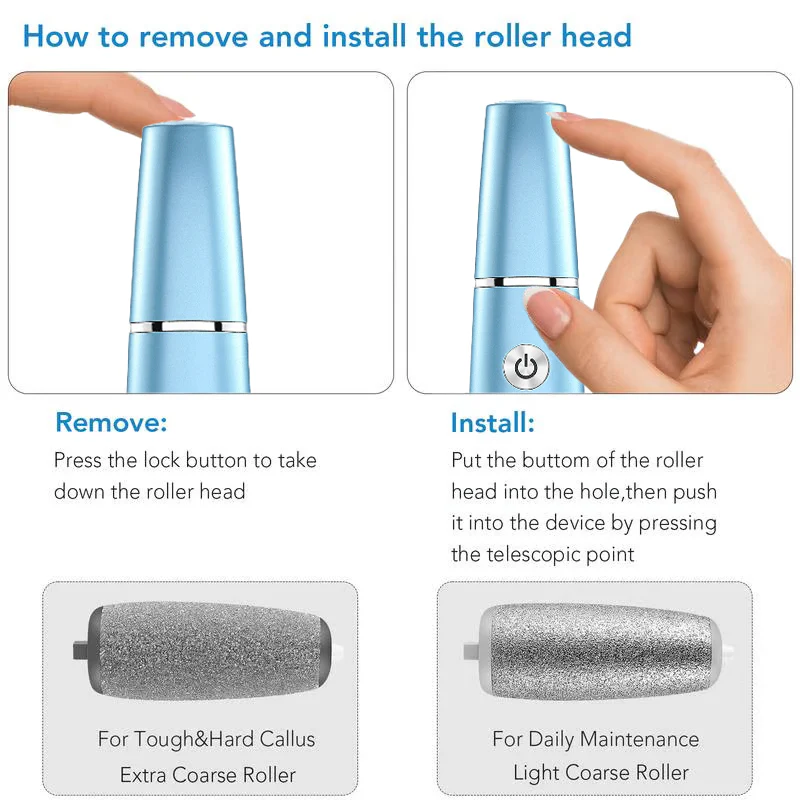 Electric Foot Callus Remover – Smooth and Soft Feet at Home