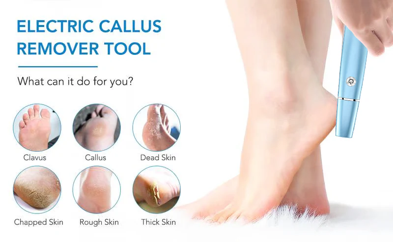 Electric Foot Callus Remover – Smooth and Soft Feet at Home