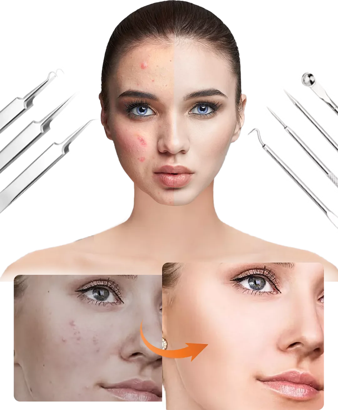 Precision Stainless Steel 8-Piece Spot Removal Tool Set