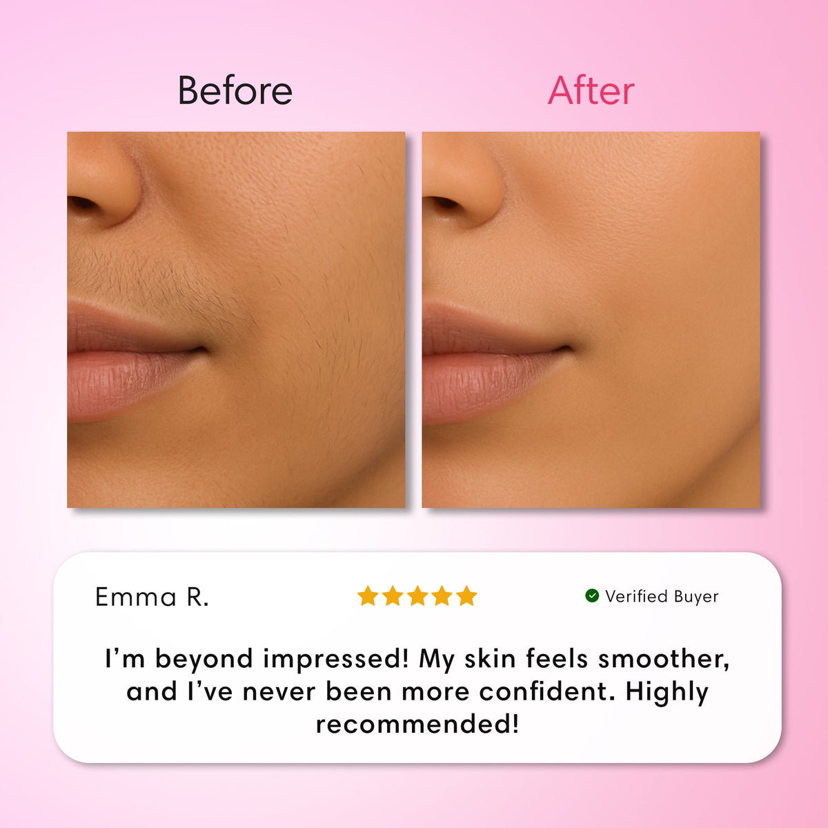 Hair Removal Trilogy Kit