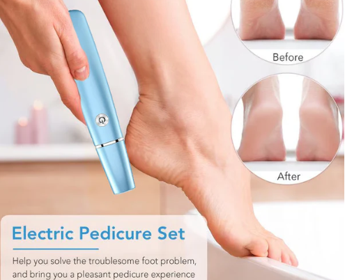 Electric Foot Callus Remover – Smooth and Soft Feet at Home