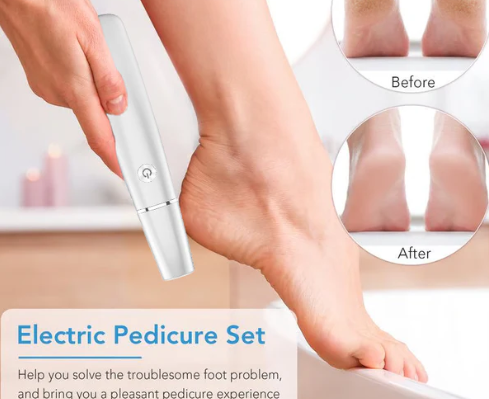 Electric Foot Callus Remover – Smooth and Soft Feet at Home