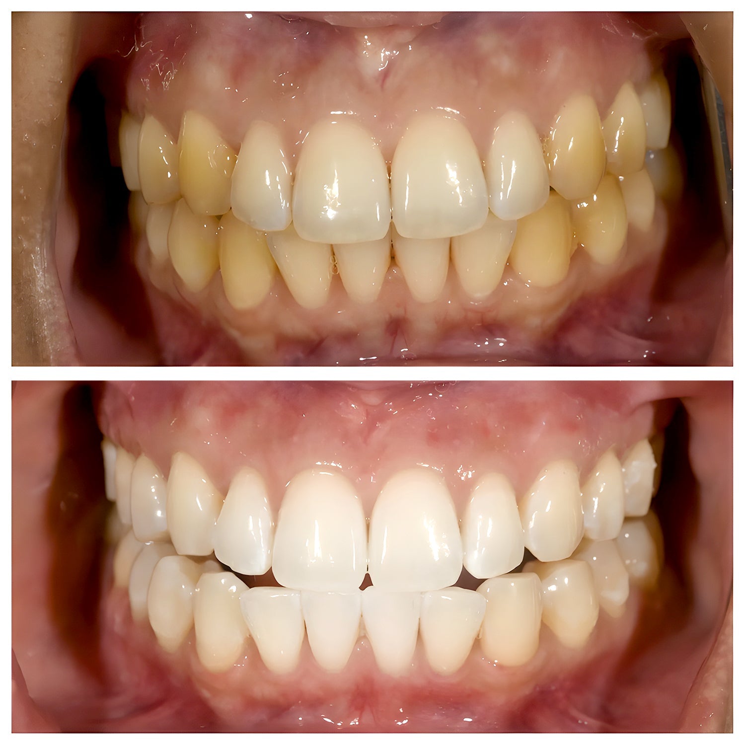 Natural Whitening And Gum Care Toothpaste