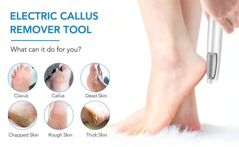 Electric Foot Callus Remover – Smooth and Soft Feet at Home
