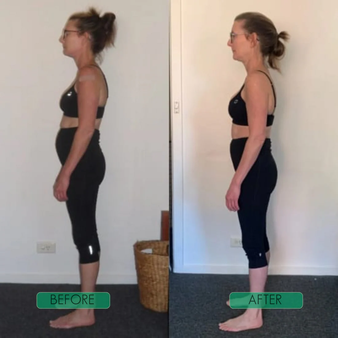 Instant Posture Corrector | Adjustable, Comfortable & Pain-Relieving