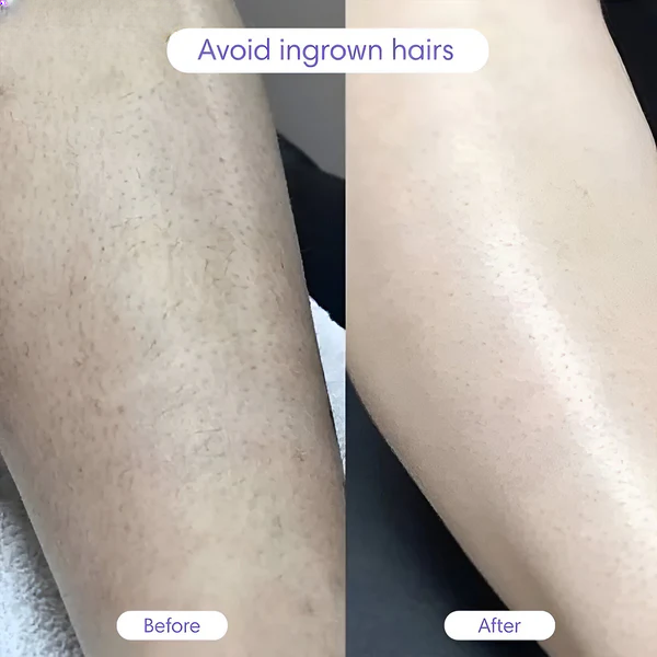 Flawless Brazilian Body Shaver