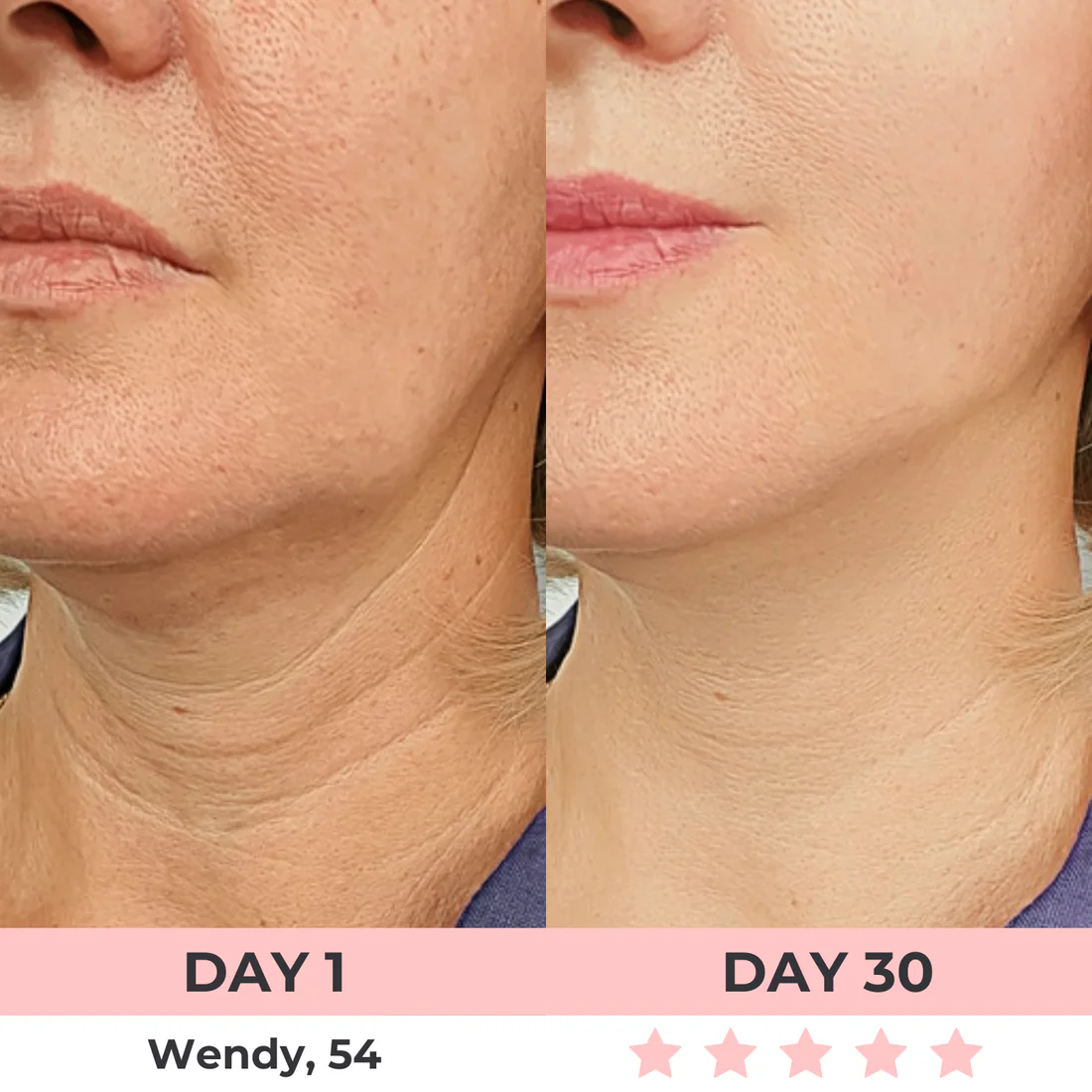 Radiant 7-In-1 LED Facial Sculptor