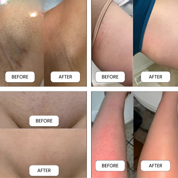 Flawless Brazilian Body Shaver