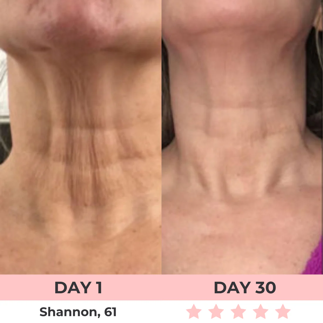 Radiant 7-In-1 LED Facial Sculptor
