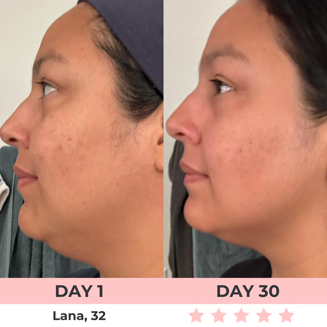 Radiant 7-In-1 LED Facial Sculptor