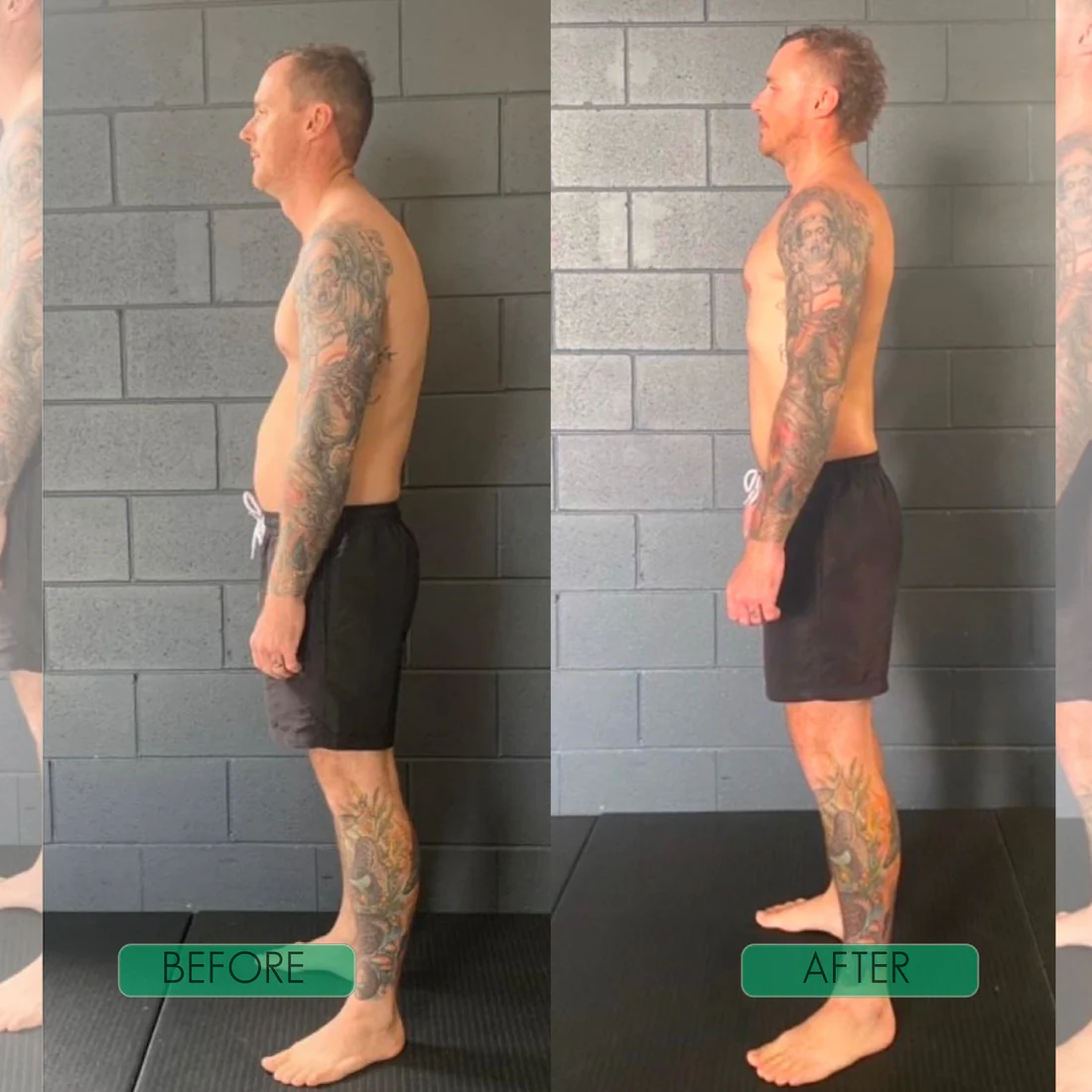 Instant Posture Corrector | Adjustable, Comfortable & Pain-Relieving