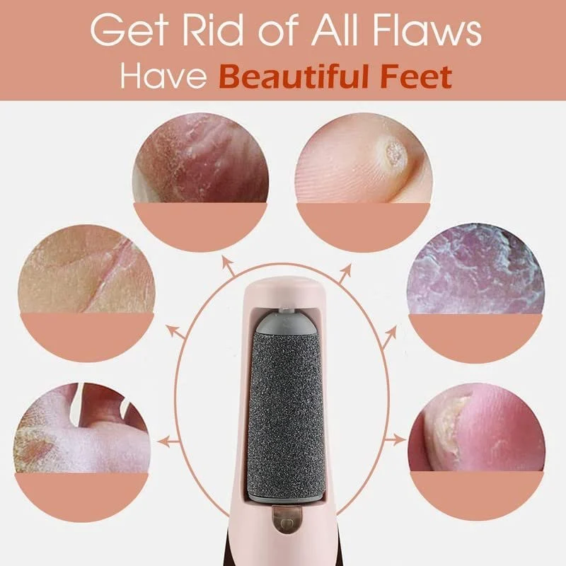 Electric Foot Callus Remover – Smooth and Soft Feet at Home