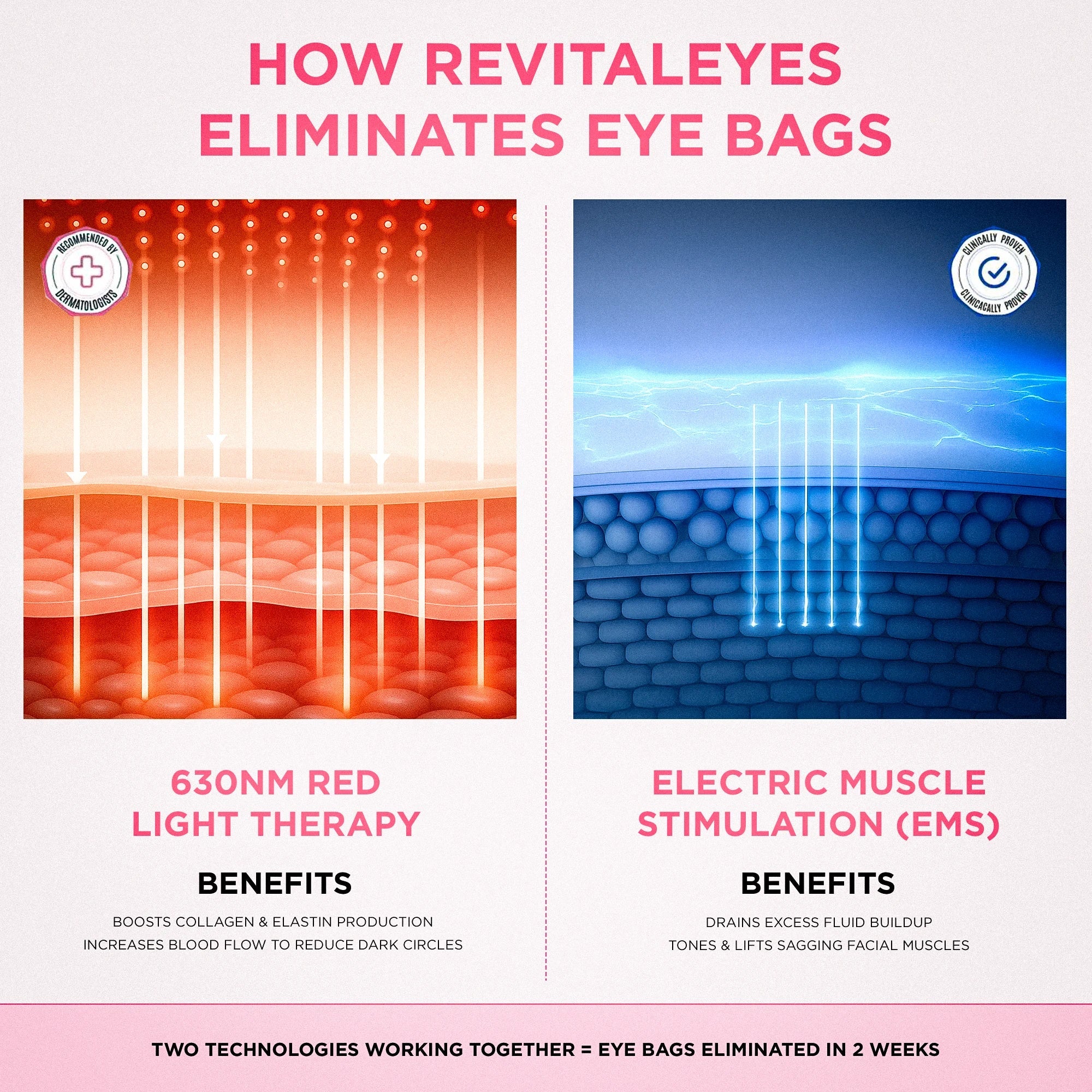RevitalEyes® — Red Light & EMS Device for Hormone-Related Under-Eye Puffiness