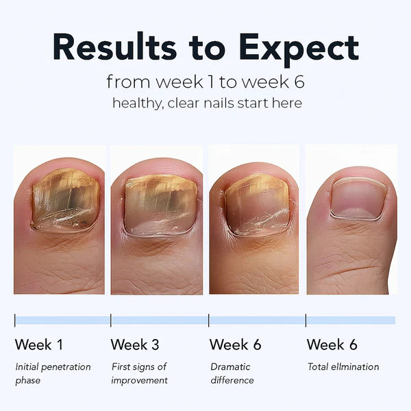 Powerful Fungal Nail Renewal Patches