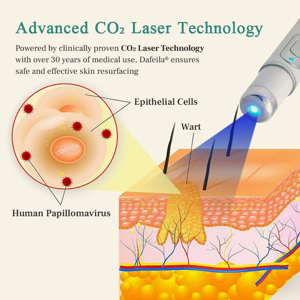 Precision Skin Perfection Laser Pen