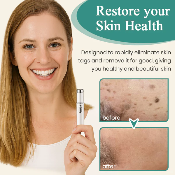 Precision Skin Perfection Laser Pen