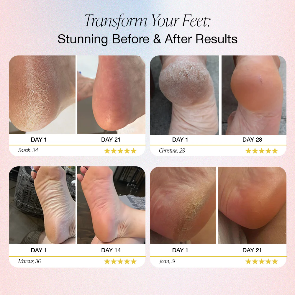 Powerful Electric Foot Callus Remove