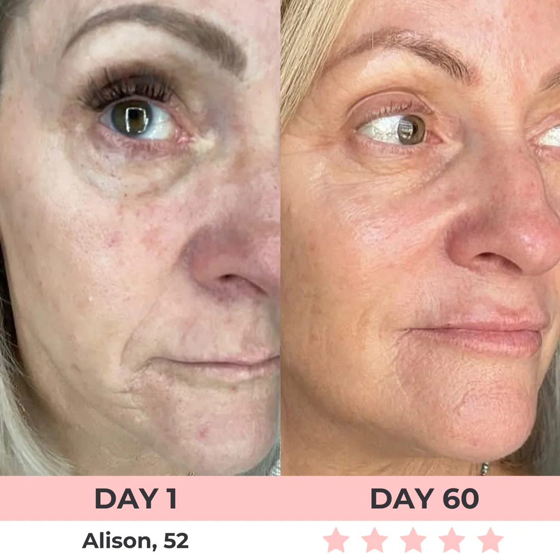 Radiant 7-In-1 LED Facial Sculptor