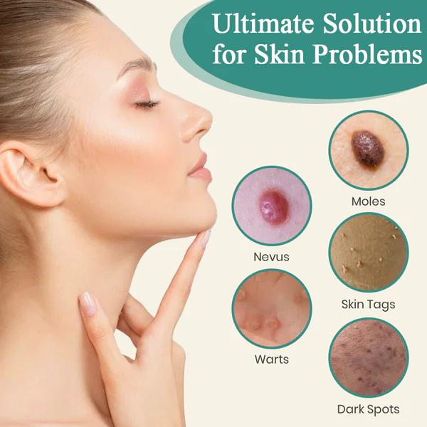 Precision Skin Perfection Laser Pen