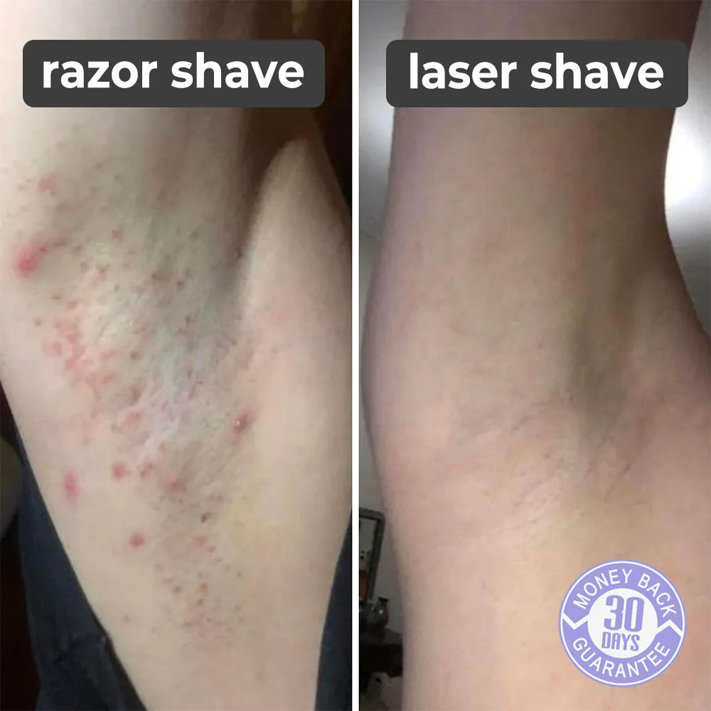 Sun-Kissed Silk Hair Eraser Pain Free