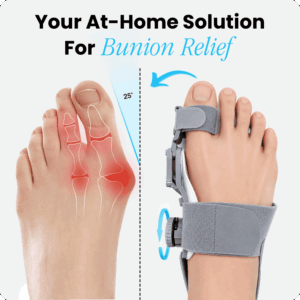 Curalis™ Bunion Relief Corrector