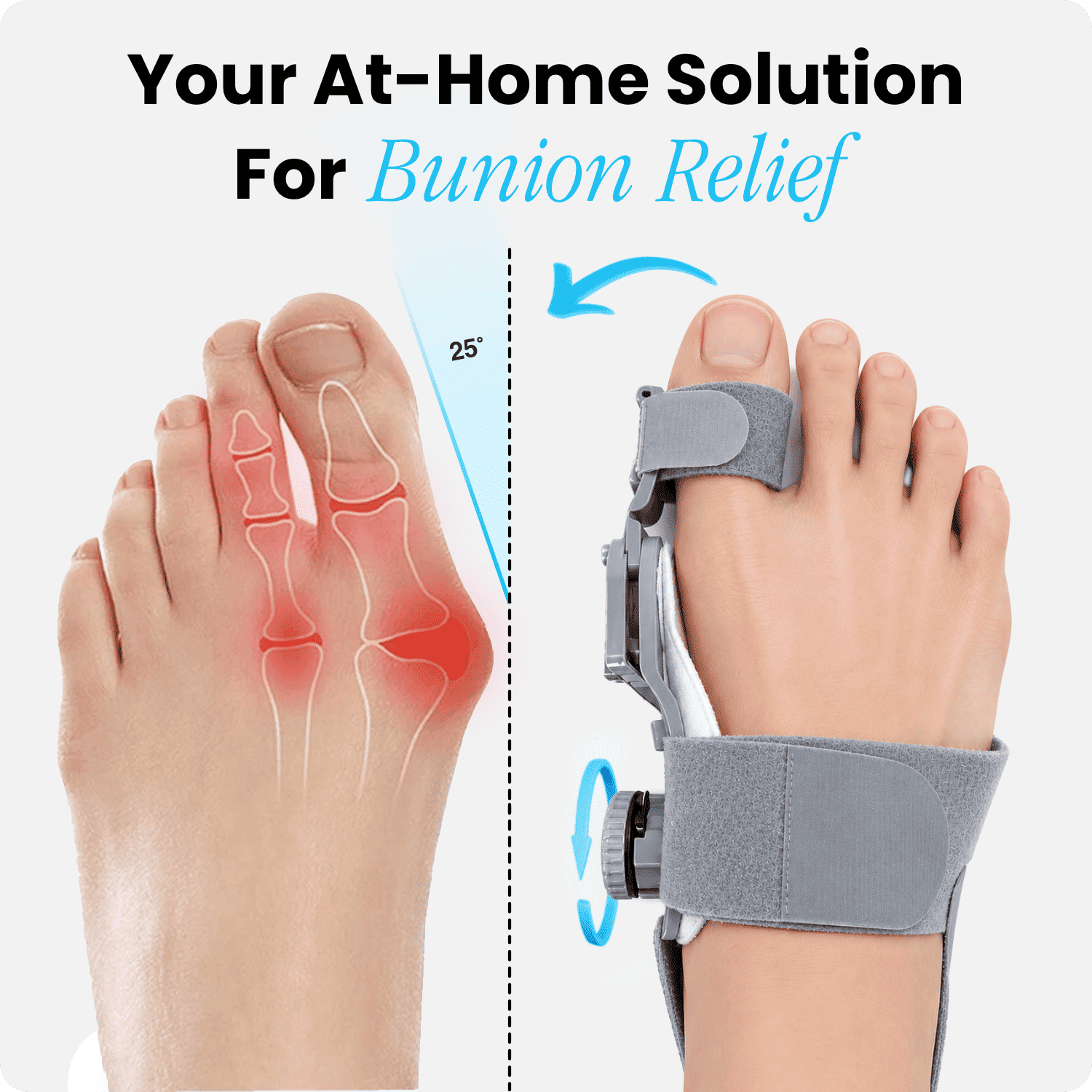 Curalis™ Bunion Relief Corrector