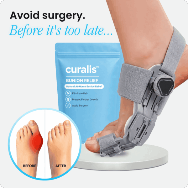 Curalis™ Bunion Relief Corrector