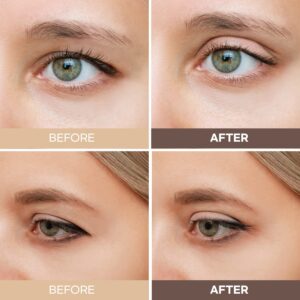 InvisibleEyeliftStrips3