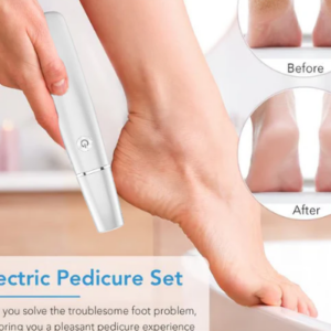 Electric Foot Callus Remover – Smooth and Soft Feet at Home