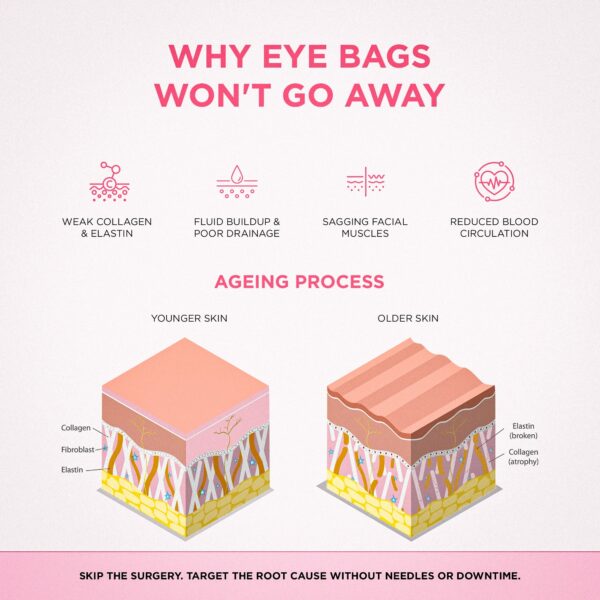 RevitalEyes® — Red Light & EMS Device for Hormone-Related Under-Eye Puffiness