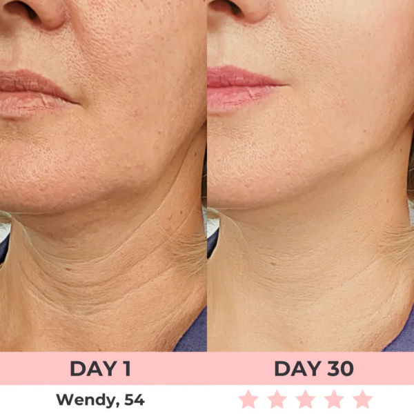 Radiant 7-In-1 LED Facial Sculptor