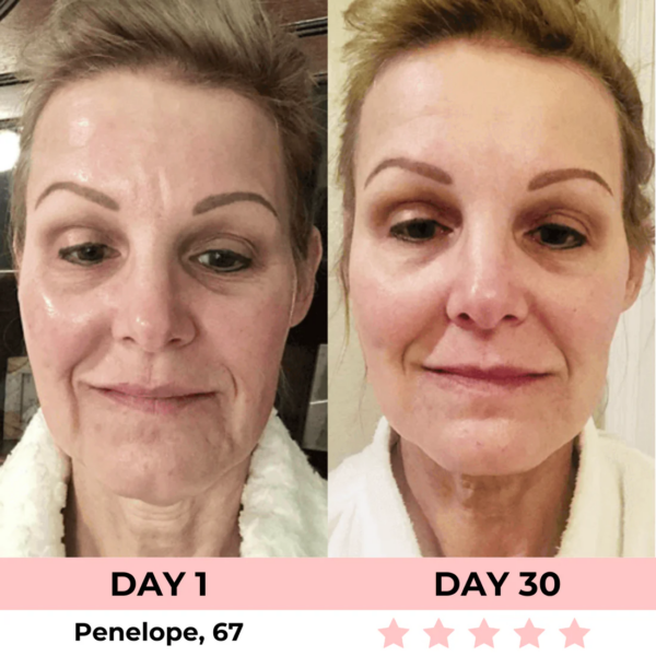 Radiant 7-In-1 LED Facial Sculptor